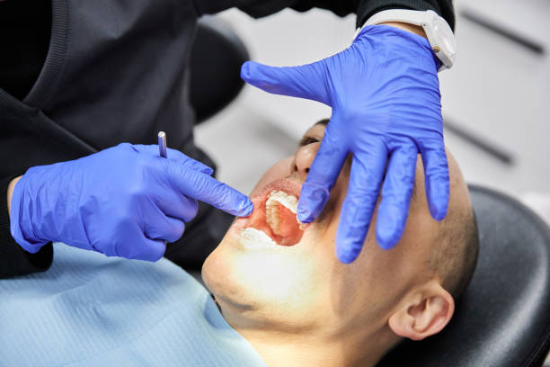 Best Emergency Dentist for Knocked-Out Tooth in Wolverine Lake, MI
