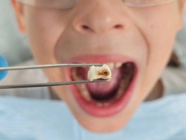 Best Emergency Dental Services for Seniors in Wolverine Lake, MI